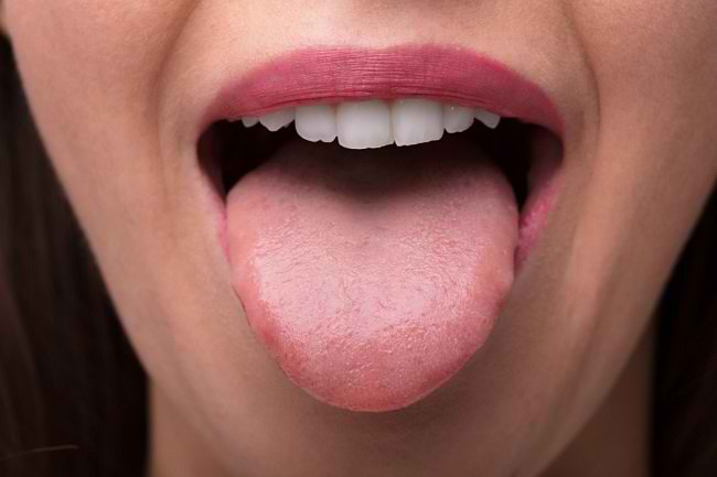 7 Tips Perawatan Lidah untuk Penderita Diabetes